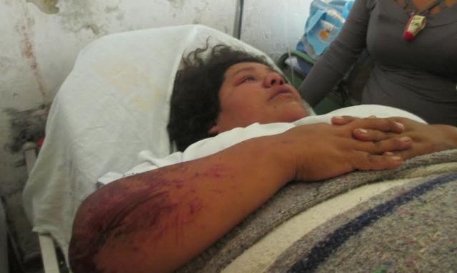 Patricia Lozada Villanueva de 28 años se encuentra internada en Hospital La Caleta.