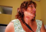 Gabriela Haro tiene profundos cortes en el cuello, pecho y en las manos.