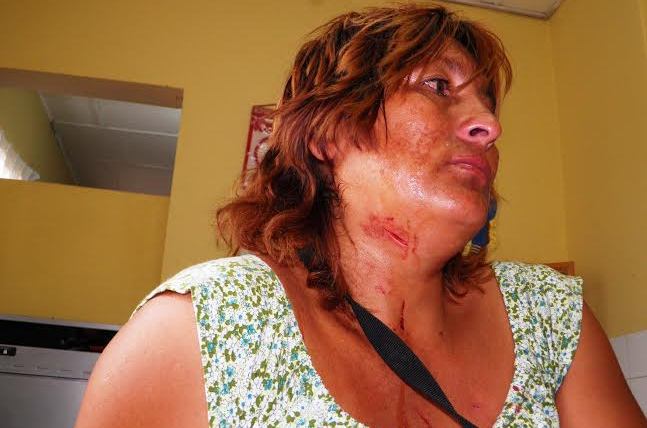 Gabriela Haro tiene profundos cortes en el cuello, pecho y en las manos.